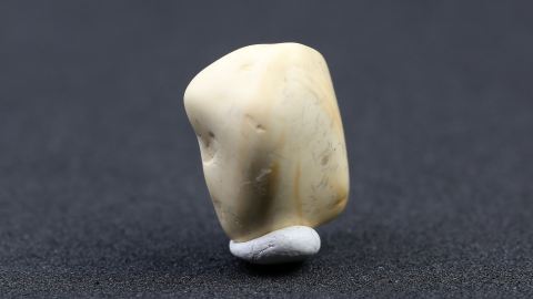 Knochenbernstein aus Goitsche Bitterfeld